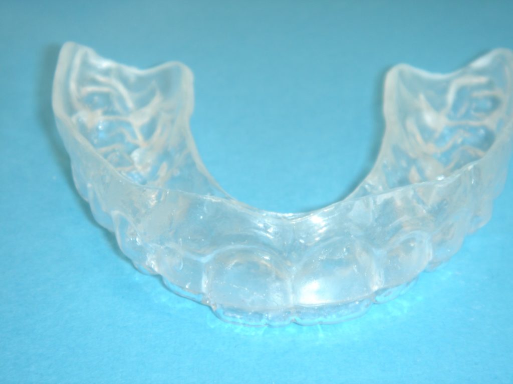 orthodontie appareil de contention