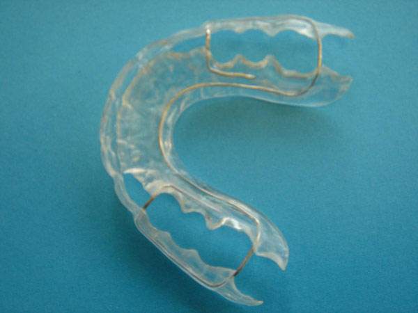 orthodontie de contention