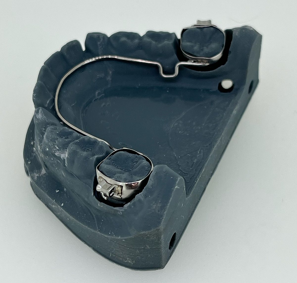 disjoncteur sur bagues orthodontie