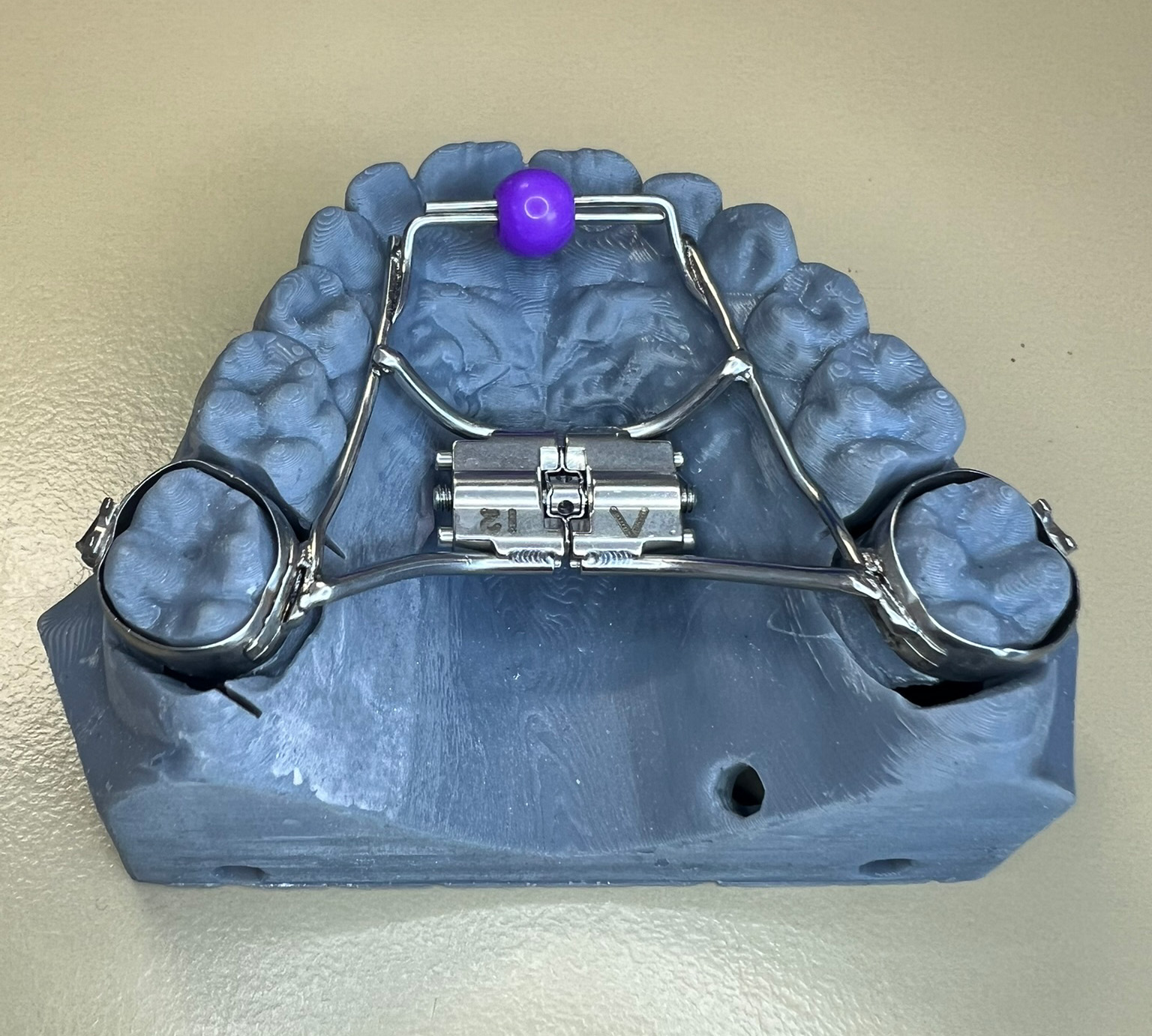 disjoncteur sur bagues orthodontie