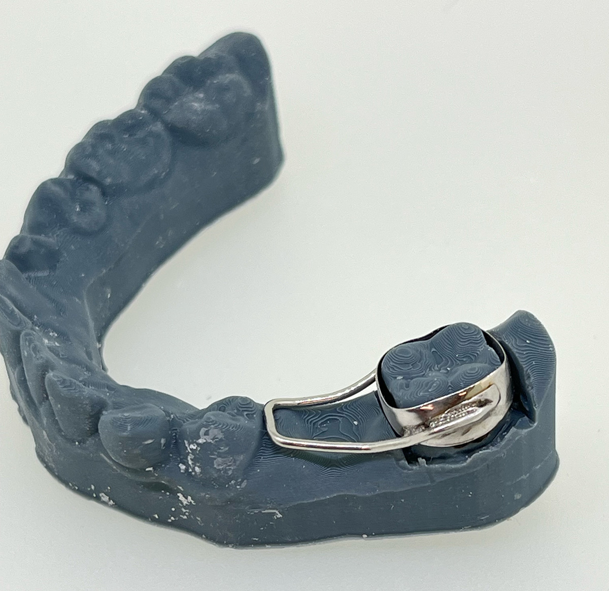 appareil Arc de Nance