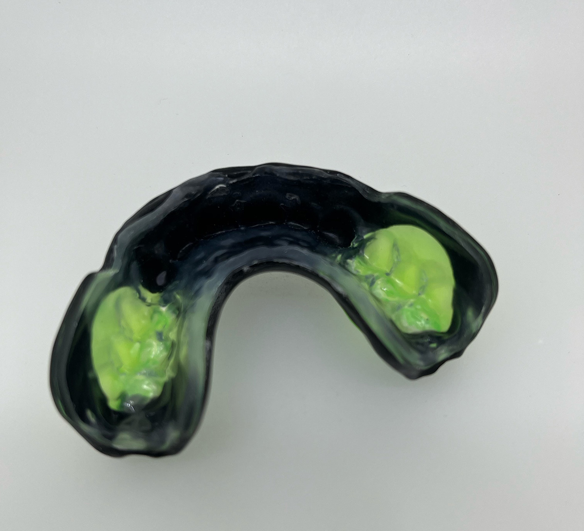 exemple protège dent pour appareil dentaire