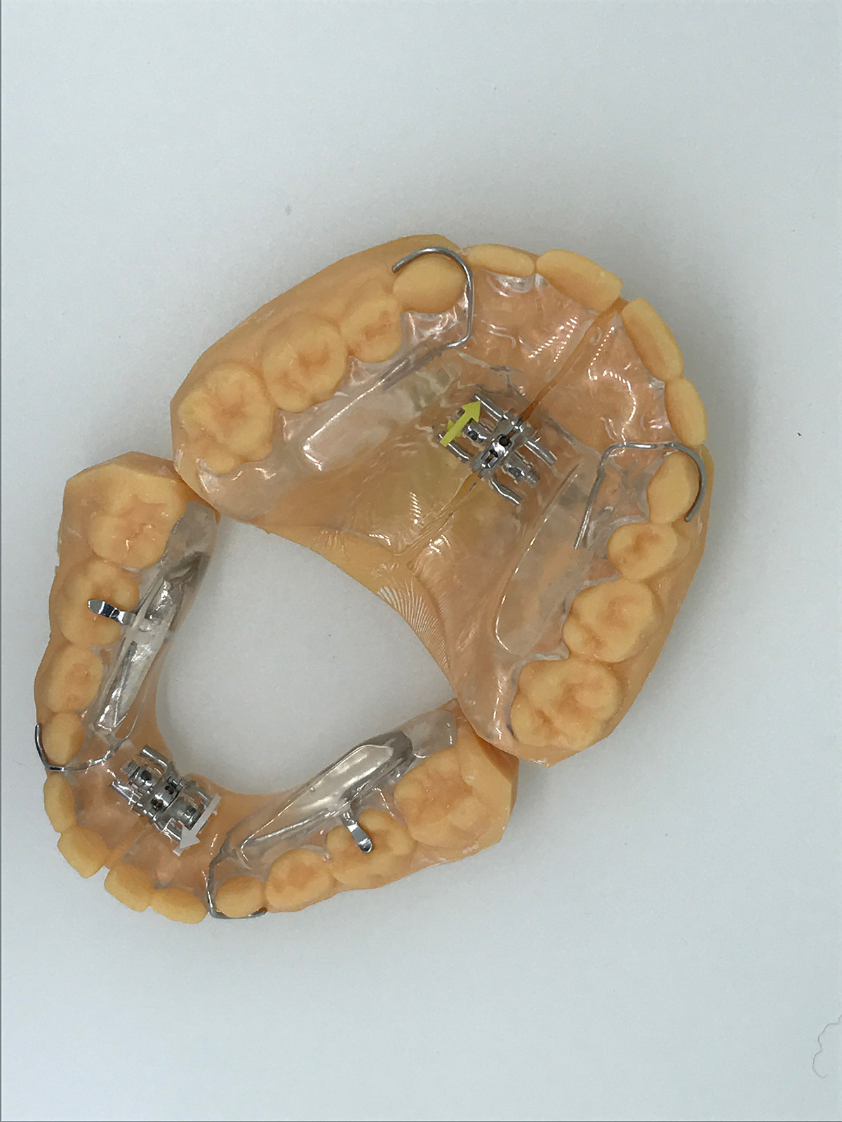 planas orthodontique